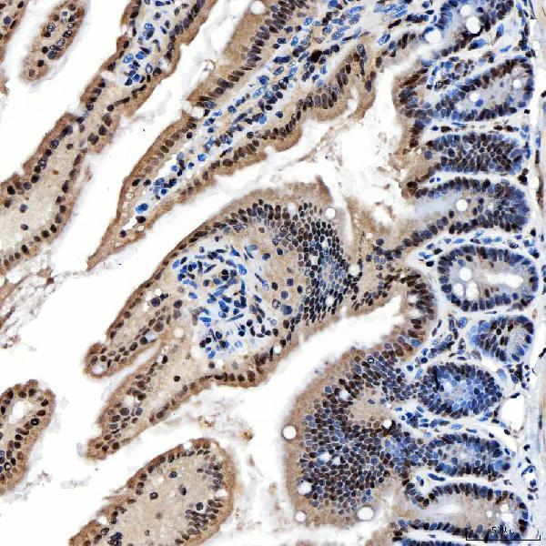 a04514 2 snrnp200 primary antibodies ihc testing 16