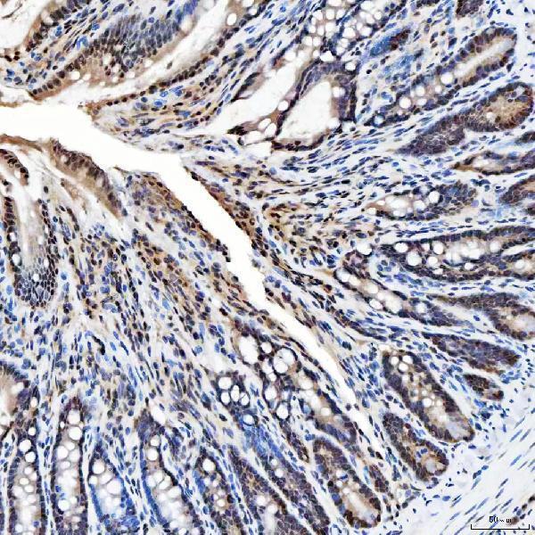 a04514 2 snrnp200 primary antibodies ihc testing 17