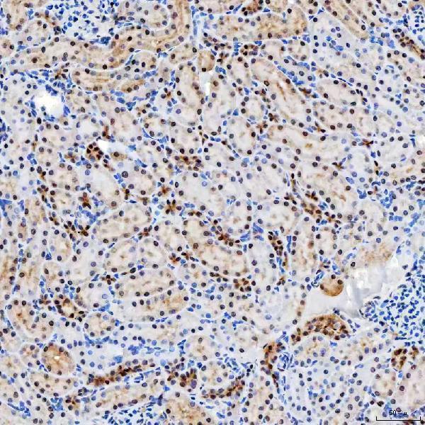 a04514 2 snrnp200 primary antibodies ihc testing 18