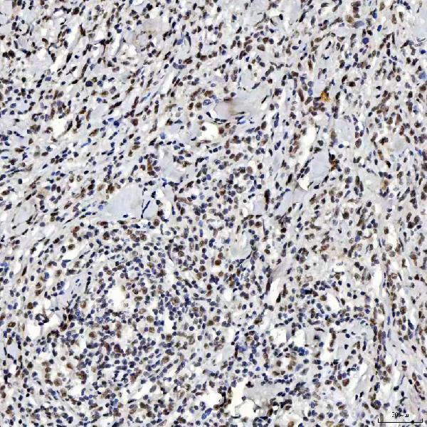  IHC analysis of SNRNP200 using anti-SNRNP200 antibody (A04514-2)