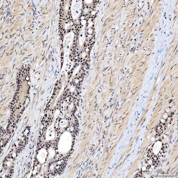  IHC analysis of SNRNP200 using anti-SNRNP200 antibody (A04514-2)