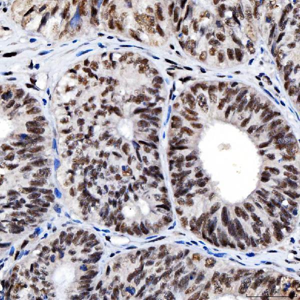 a04514 2 snrnp200 primary antibodies ihc testing 4