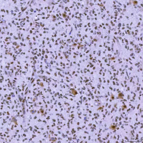 a04514 2 snrnp200 primary antibodies ihc testing 5