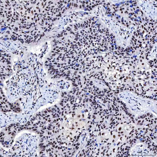 a04514 2 snrnp200 primary antibodies ihc testing 6