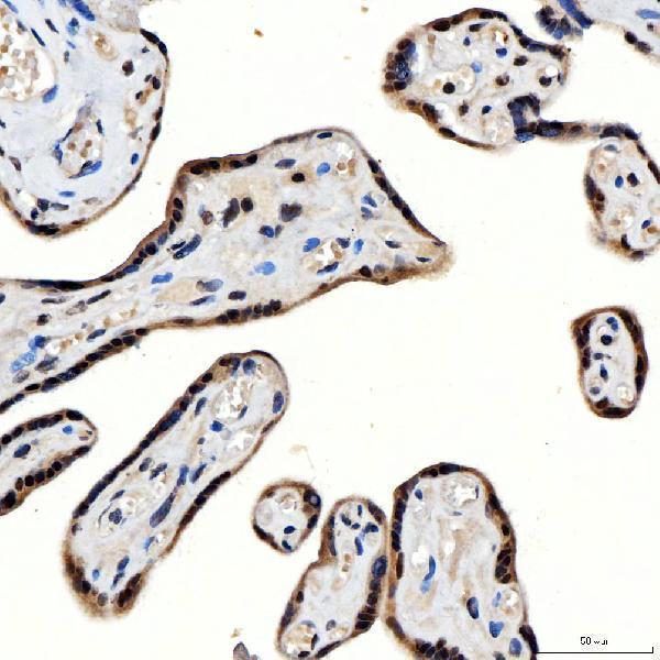 a04514 2 snrnp200 primary antibodies ihc testing 9