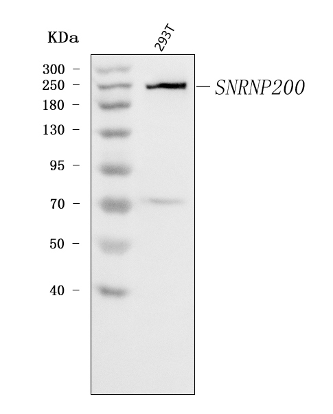  Western blot analysis of SNRNP200 using anti-SNRNP200 antibody (A04514-2)