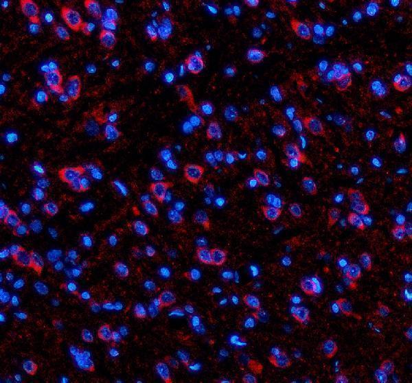 a04515 1 sik2 primary antibodies if testing 1