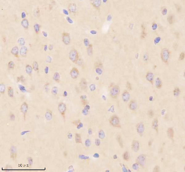 IHC analysis of SIK2 using anti-SIK2 antibody (A04515-1)