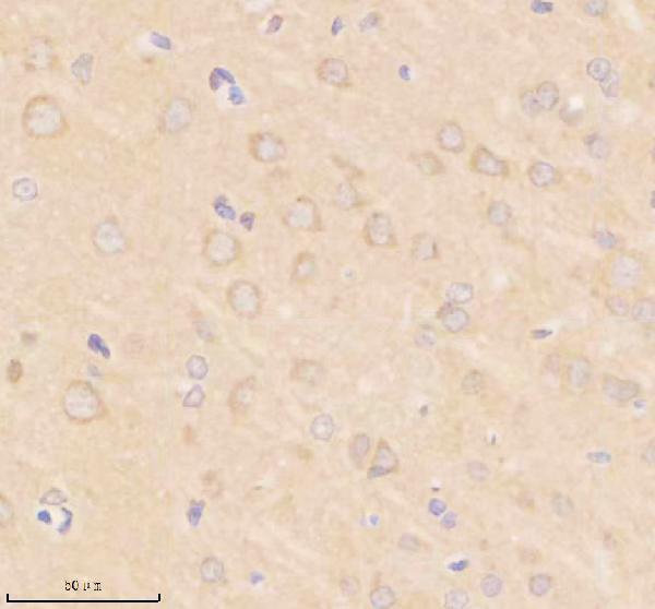 IHC analysis of SIK2 using anti-SIK2 antibody (A04515-1)