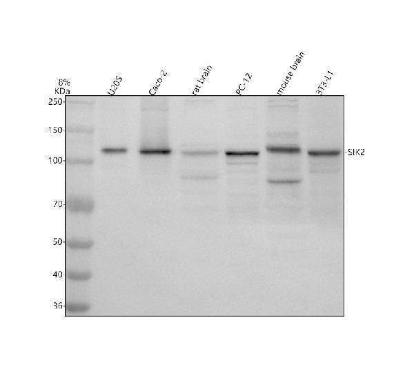 Western blot analysis of SIK2 using anti-SIK2 antibody (A04515-1)