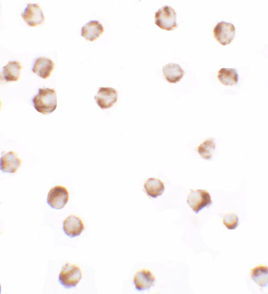 Immunocytochemistry of SIK2 in SW480 cells with SIK2 antibody at 2