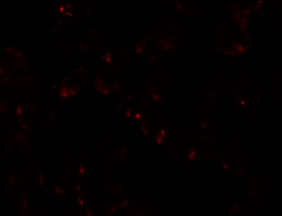 Immunofluorescence of SIK2 in SW480 cells with SIK2 antibody at 5 μg/ml