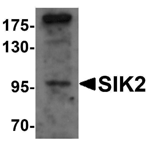 Western blot analysis of SIK2 in SW480 cell lysate with SIK2 antibody at 1 μg/mL