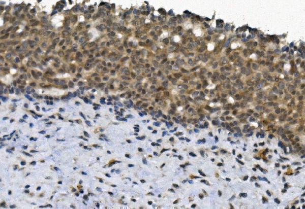 a04516 3 eya4 primary antibodies ihc testing 2