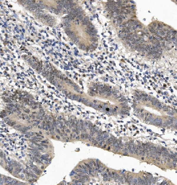 a04516 3 eya4 primary antibodies ihc testing 3