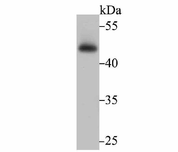Western blot analysis of Flotillin 1 on PC-3M cell lysate using anti-Flotillin 1 antibody at 1/500 dilution