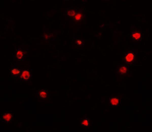 a04518 pibf1 primary antibodies if testing 3