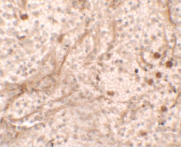 a04518 pibf1 primary antibodies ihc testing 2