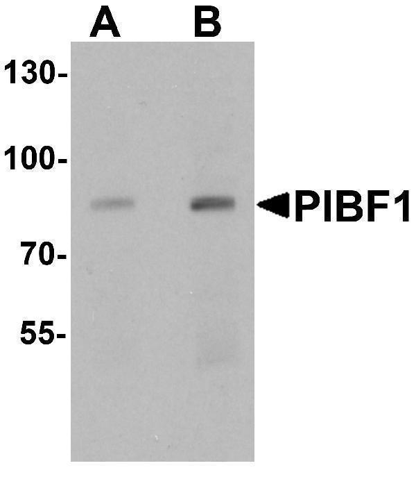 a04518 pibf1 primary antibodies wb testing 1