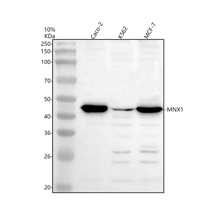 a04520 2 mnx1 primary antibodies wb testing 1