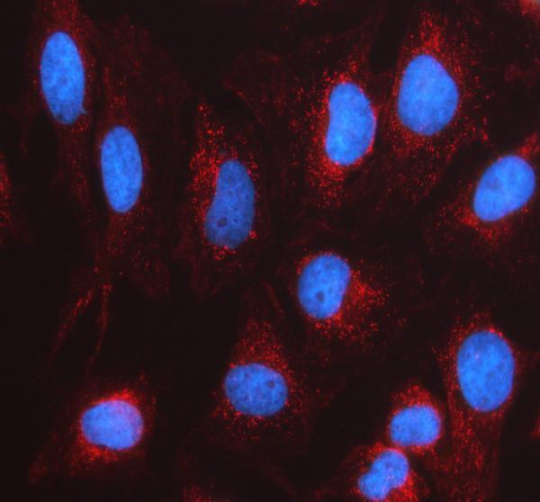 a04521 2 lrpap1 primary antibodies if testing 1