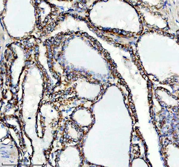 a04521 2 lrpap1 primary antibodies ihc testing 1