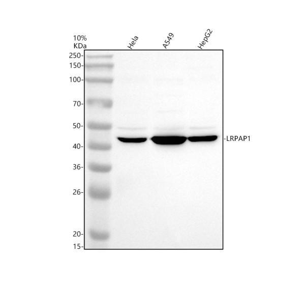 a04521 2 lrpap1 primary antibodies wb testing 1