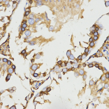 Immunohistochemistry (IHC) analysis of LRPAP1 polyclonal antibody in paraffin-embedded Rat Testis tissue
