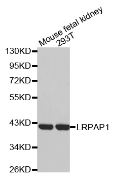 Western blot (WB) analysis of LRPAP1 polyclonal antibody