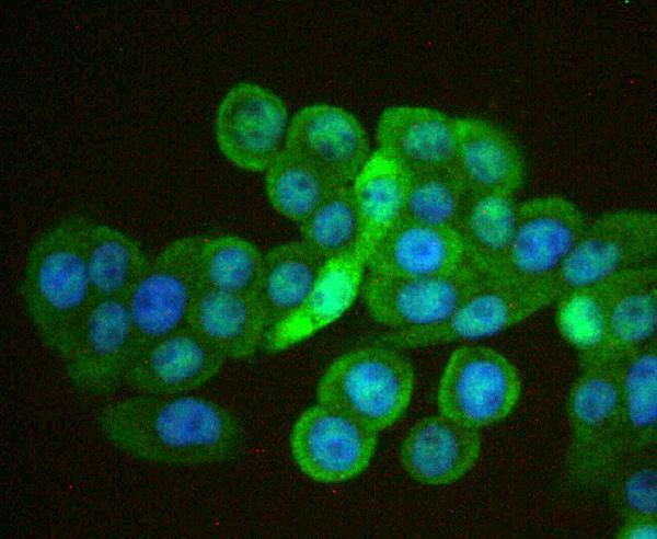 ICC staining Cdx1 in HOVO cells (green)