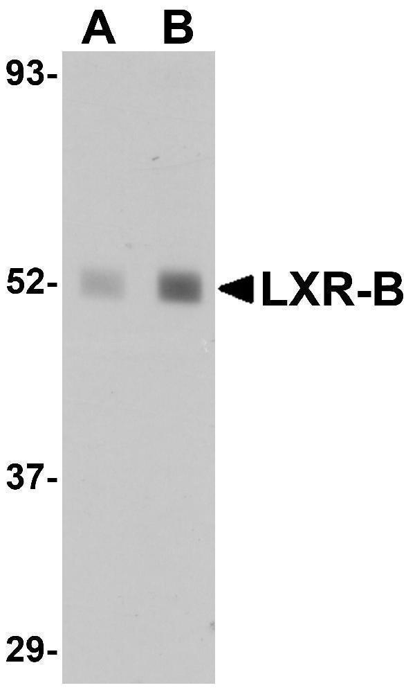 Western blot analysis of LXR-B in human lung tissue lysate with LXR-B antibody at (A) 1 and (B) 2 μg/mL