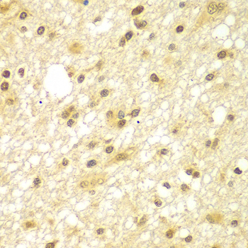 a04524 1 tbl1xr1 primary antiboties if testing 3