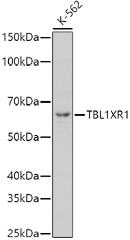a04524 1 tbl1xr1 primary antiboties wb testing 1