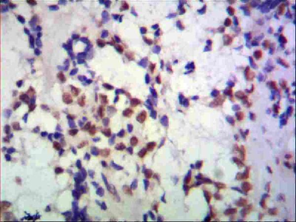 a04524 tbl1xr1 primary antibodyes ihc testing 1