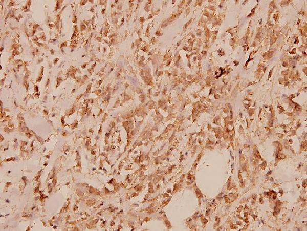 a04527 2 il13ra1 primary antiboties ihc testing 2