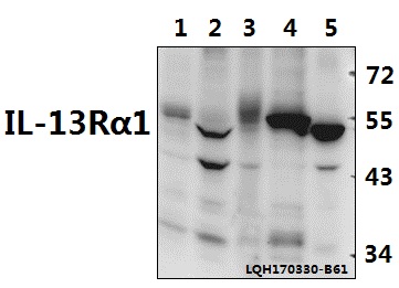 a04527 2 il13ra1 primary antiboties wb testing 1