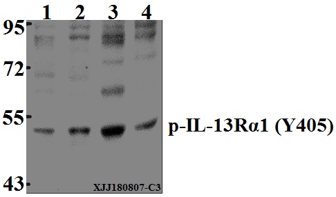 a04527y405 il13ra1 primary antiboties wb testing 1