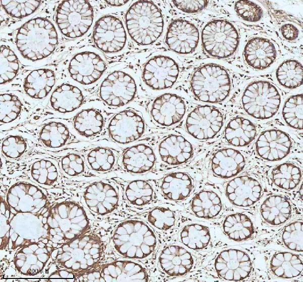  IHC analysis of MYH14 using anti-MYH14 antibody (A04528-3)