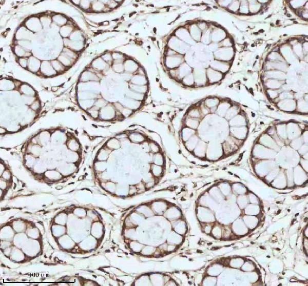  IHC analysis of MYH14 using anti-MYH14 antibody (A04528-3)