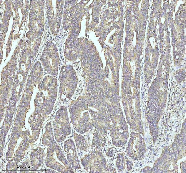 a04528 3 myh14 primary antibodies ihc testing 4