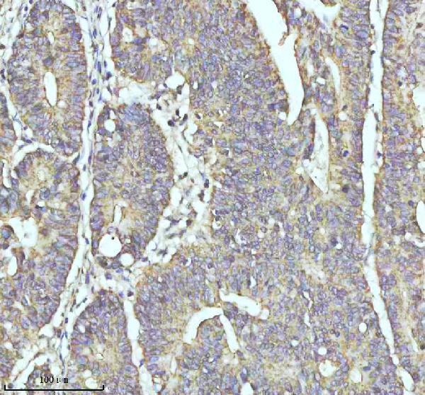 a04528 3 myh14 primary antibodies ihc testing 5