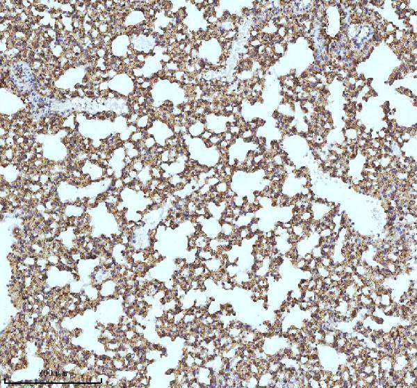 a04528 3 myh14 primary antibodies ihc testing 6