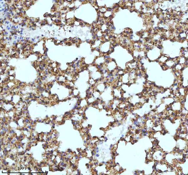 a04528 3 myh14 primary antibodies ihc testing 7