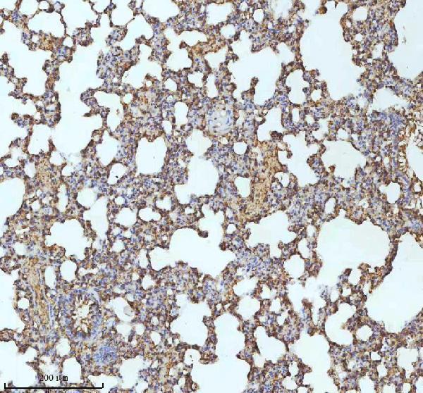a04528 3 myh14 primary antibodies ihc testing 8