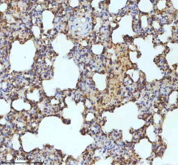 a04528 3 myh14 primary antibodies ihc testing 9