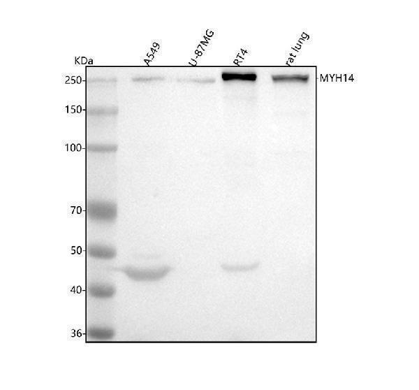  Western blot analysis of MYH14 using anti-MYH14 antibody (A04528-3)