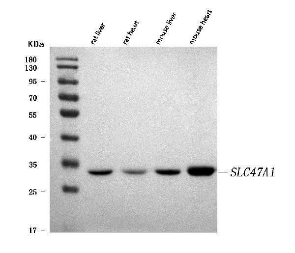  Western blot analysis of MATE-1/SLC47A1 using anti-MATE-1/SLC47A1 antibody (A04529-2)