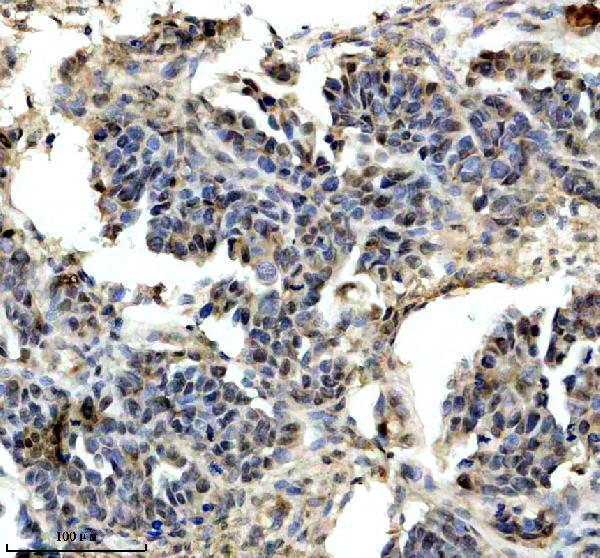 IHC analysis of SIP1/GEMIN2 using anti-SIP1/GEMIN2 antibody (A04530-2)