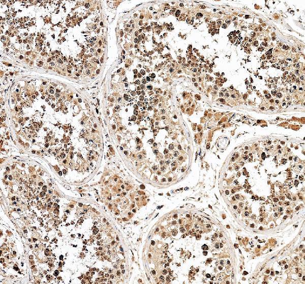 IHC analysis of SIP1/GEMIN2 using anti-SIP1/GEMIN2 antibody (A04530-2)