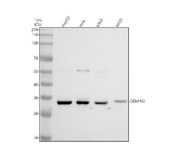 Western blot analysis of SIP1/GEMIN2 using anti-SIP1/GEMIN2 antibody (A04530-2)